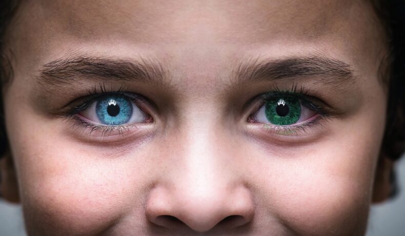 Copil cu heterocromie, care are fiecare ochi în nuanțe diferite, albastru și verde. Heterocromia poate include cea mai rară culoare de ochi din lume
