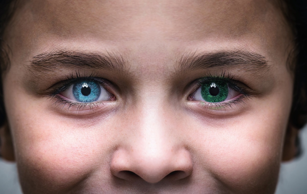 Copil cu heterocromie, care are fiecare ochi în nuanțe diferite, albastru și verde. Heterocromia poate include cea mai rară culoare de ochi din lume
