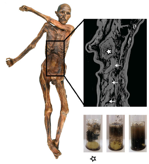 Detalii cu stomacul lui Otzi, Omul Zăpezilor. Cercetătorii au aflat care a fost ultima masă a lui Otzi