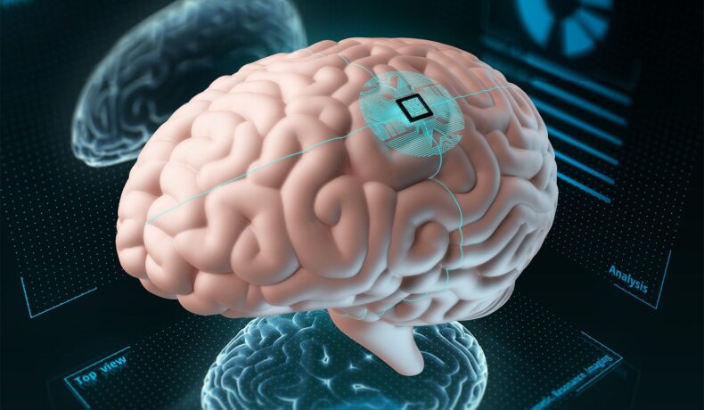 Creier cu un cip în el, similar cu cipul de creier Neuralink, care îngrijorează experții, pe un fundal negru cu albastru