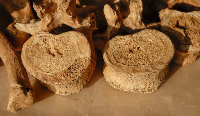 Vertebre umane vechi, pe un fundal bej. 200 de coloane vertebrale umane au fost descoperite în Peru