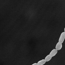 Cea mai mare bacterie din lume, T. magnifica, albă, pe fundal negru