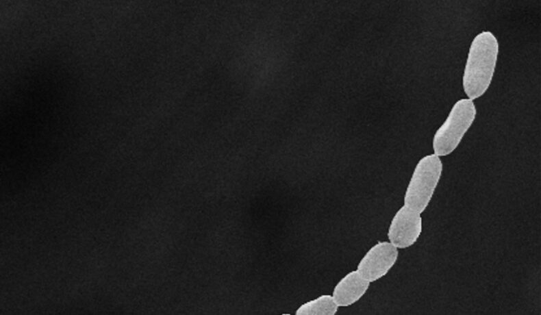 Cea mai mare bacterie din lume, T. magnifica, albă, pe fundal negru
