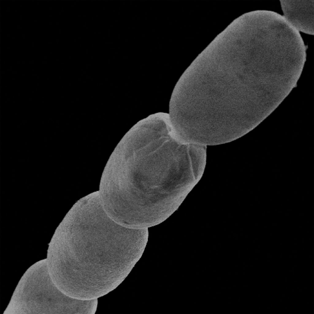 T. magnifica, cea mai mare bacterie din lume, pe fundal negru