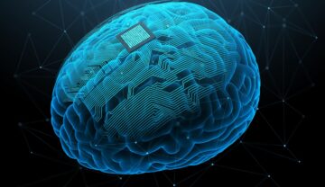 Creier cu cip, pe fundal negru, în nuanțe de albastru. Synchron a implantat un dispozitiv în creierul unui pacient din SUA