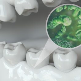 Imagine cu dinți și un ecran cu bacterii verzi. Recent, a fost publicat un studiu despre organismul care se găsește în gura oamenilor