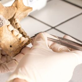 Expert care analizează mandibulă umană. Un dinte uman vechi de 1.8 milioane de ani a fost descoperit