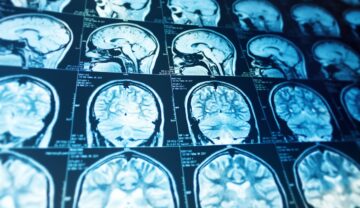 Radiografie a creierului, ce are o nouă funcție