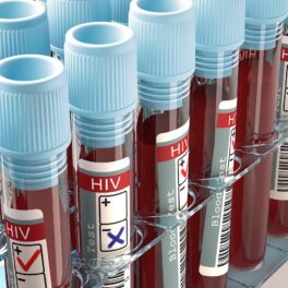 Mostre de sânge cu HIV, cu capace albastre. Experții au confirmat un nou caz de vindecare HIV