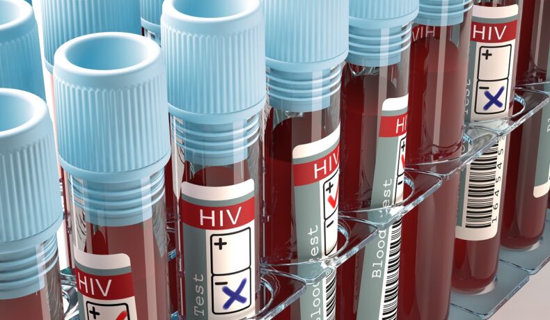 Mostre de sânge cu HIV, cu capace albastre. Experții au confirmat un nou caz de vindecare HIV